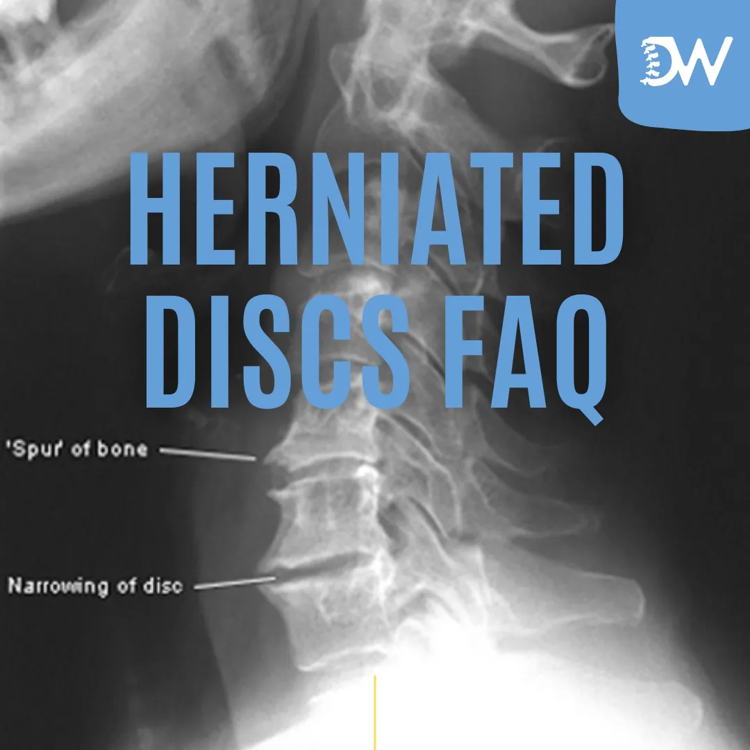 Herniated disc anatomy and treatment consultation at District Wellness Arlington VA